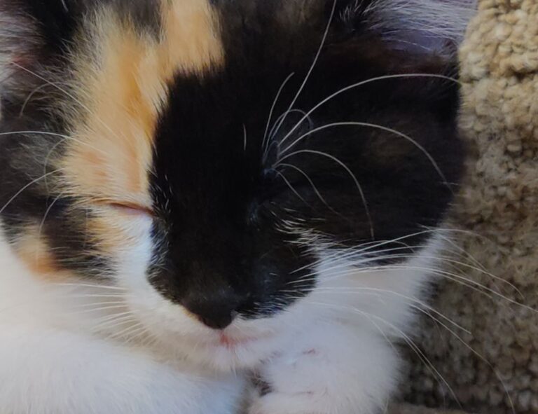 does liposuction work fntkdiet